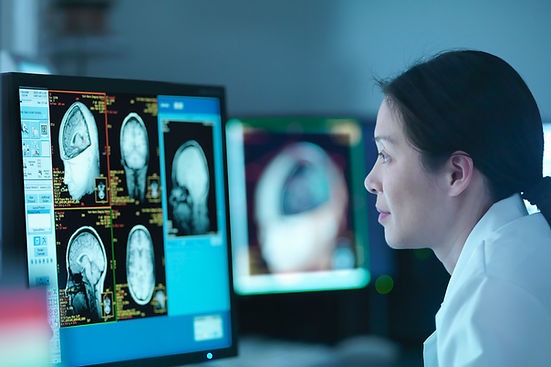 Médecin analysant des scanners cérébraux